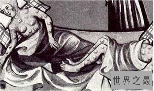 【图】黑死病是什么 一种十分恐惧的传染病