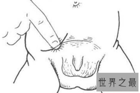 【图】腹股沟区往常不易惹起注重 然而它的性能性却不