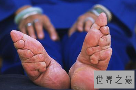 【图】裹脚是一种可怕的传统风俗 它的寓意是如此的美