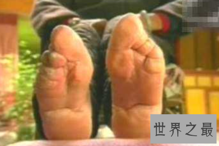 【图】裹脚是一种可怕的传统风俗 它的寓意是如此的美