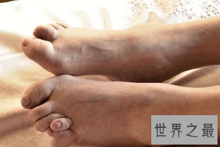 【图】裹脚是一种可怕的传统风俗 它的寓意是如此的美