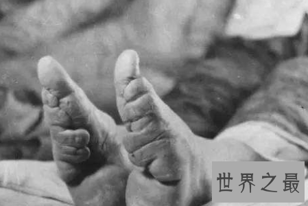 【图】裹脚是一种可怕的传统风俗 它的寓意是如此的美
