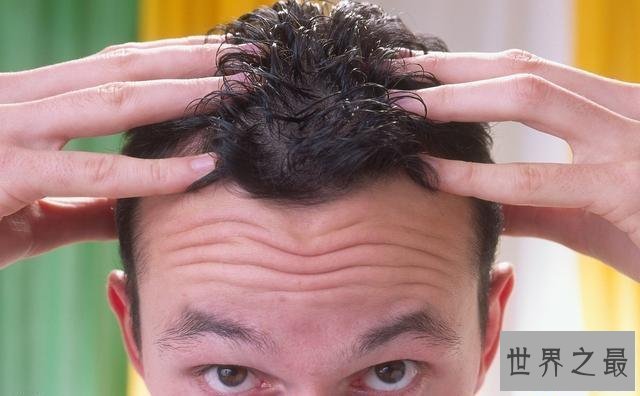 【图】生发小妙招，还在为由于本人长不进去的头发而