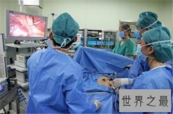 【图】切除胆囊的后果很严重 万不得已不能切除胆囊
