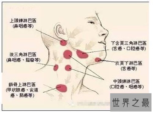【图】颈部淋巴结分区引见 淋巴结肿大的缘由引见