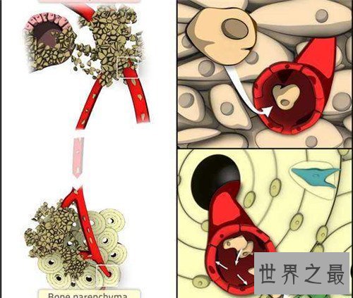 【图】乳腺癌骨转移能治疗吗 怎么可能疼痛缓解