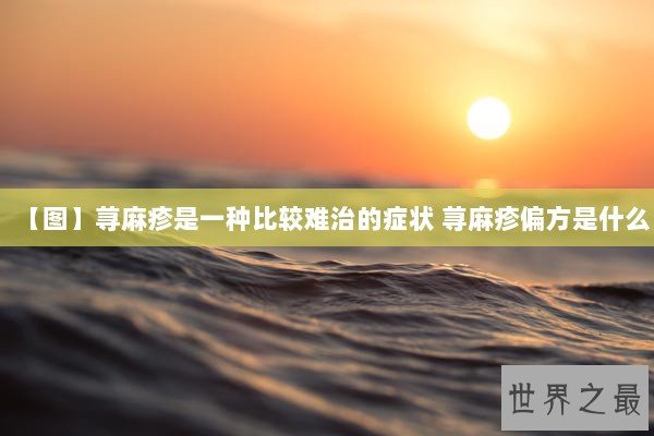 【图】荨麻疹是一种比较难治的症状 荨麻疹偏方是什么