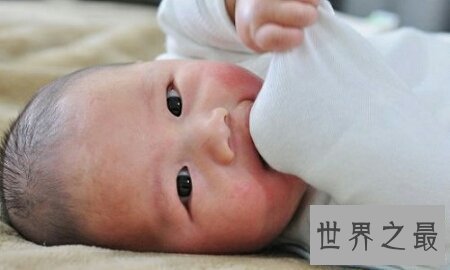 【图】荨麻疹是一种比较难治的症状 荨麻疹偏方是什么