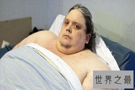 【图】看见世界上最胖的人 你会发现本人基本不用减肥