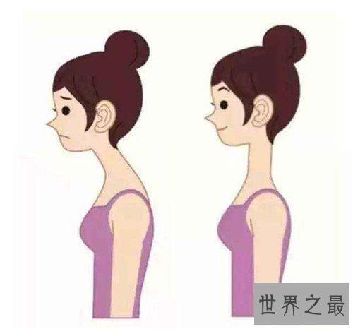【图】含胸是什么意思 怎样改善不良含胸驼背习气