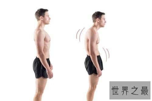 【图】含胸是什么意思 怎样改善不良含胸驼背习气