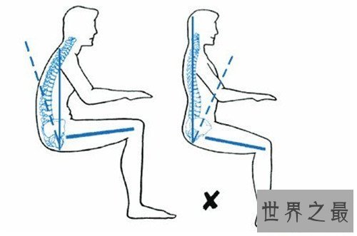 【图】含胸是什么意思 怎样改善不良含胸驼背习气