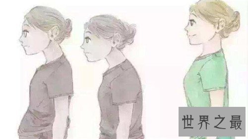 【图】含胸是什么意思 怎样改善不良含胸驼背习气