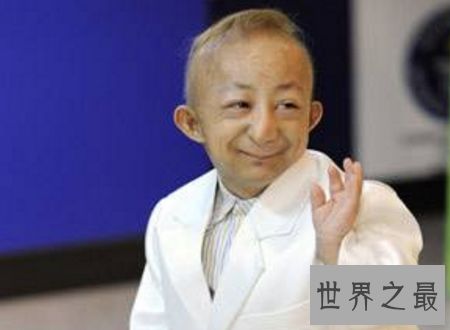 【图】世界上最矮的人身高矮但有着暖和人心的浅笑