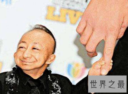 【图】世界上最矮的人身高矮但有着暖和人心的浅笑