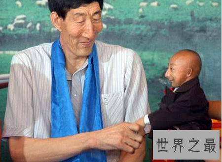 【图】世界上最矮的人身高矮但有着暖和人心的浅笑