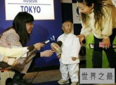 【图】世界上最矮的人身高矮但有着温暖人心的微笑