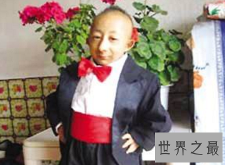 【图】世界上最矮的人身高矮但有着暖和人心的浅笑