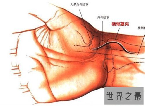 【图】动脉血气剖析是什么意思 它能提供什么样的信息