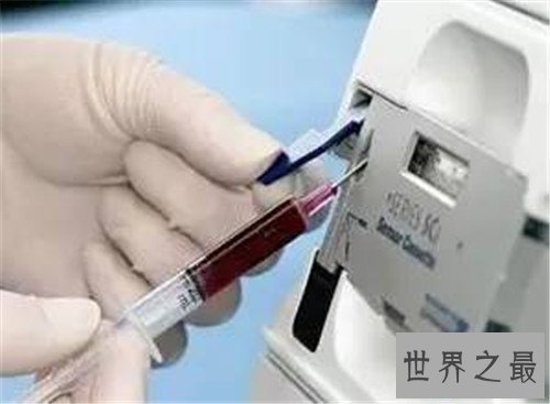 【图】动脉血气剖析是什么意思 它能提供什么样的信息