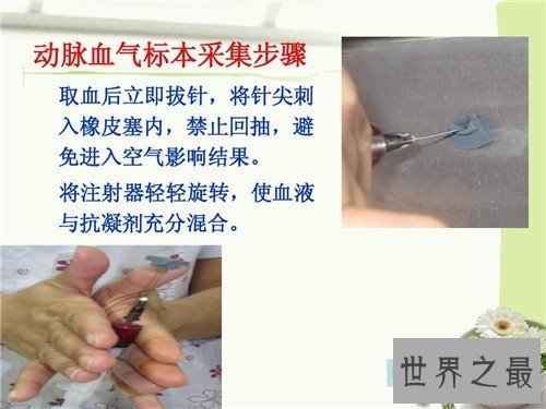 【图】动脉血气剖析是什么意思 它能提供什么样的信息