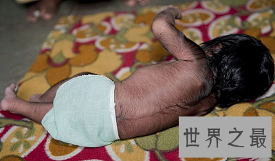 【图】艾米丽·苏珊 世界上体毛最长的人竟是大美女！