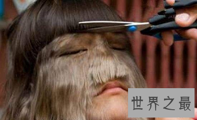 【图】艾米丽·苏珊 世界上体毛最长的人竟是大美女！