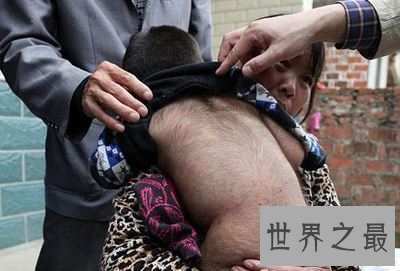 【图】艾米丽·苏珊 世界上体毛最长的人竟是大美女！