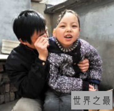 【图】话说美国有一个半脑哥 可是他到底是怎么活上去