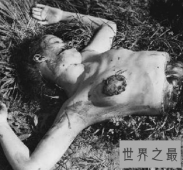 【图】世界悬疑黑色大丽花惨案 凶手竟是救死扶伤的医