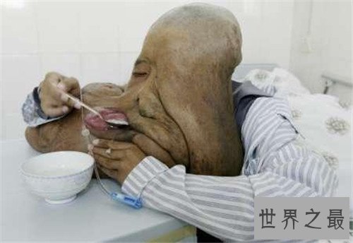 【图】世界上最丑的人是谁 不同国家最丑的人各有奇怪
