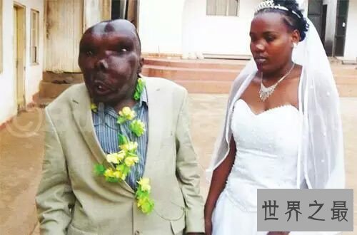 【图】世界上最丑的人是谁 不同国家最丑的人各有奇怪