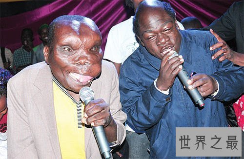 【图】世界上最丑的人是谁 不同国家最丑的人各有奇怪