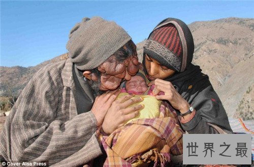 【图】世界上最丑的人是谁 不同国家最丑的人各有奇怪