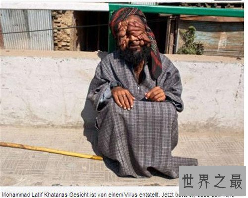 【图】世界上最丑的人是谁 不同国家最丑的人各有奇怪