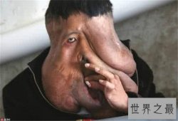 【图】世界上最丑的人是谁 不同国家最丑的人各有奇特