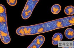 【图】世界上最危险的10种细菌 结核分枝杆菌位居榜首