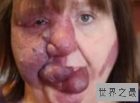 【图】世界上最丑的人只管丑然而他们很温柔