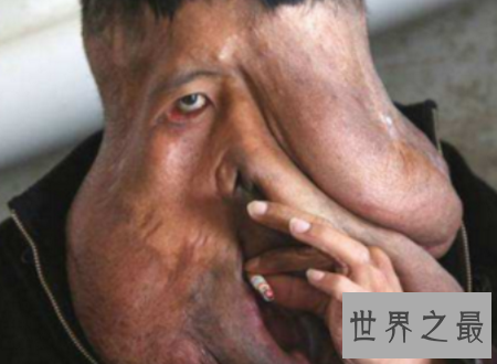 【图】世界上最丑的人只管丑然而他们很温柔