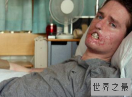 【图】世界上最丑的人只管丑然而他们很温柔