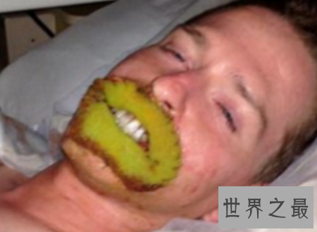 【图】世界上最丑的人只管丑然而他们很温柔