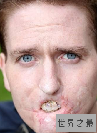 【图】世界上最丑的人只管丑然而他们很温柔