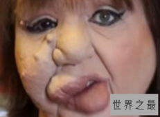 【图】世界上最丑的人虽然丑但是他们很温柔