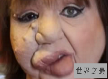 【图】世界上最丑的人只管丑然而他们很温柔