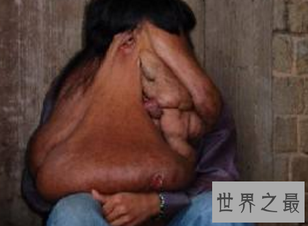 【图】世界上最丑的人只管丑然而他们很温柔