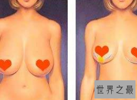 【图】下垂乳房女人必须知道的颐养身材诀窍