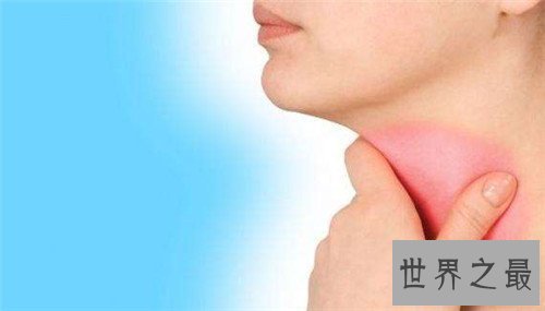 【图】咽炎的治疗方法有哪些 不迭时治疗很有能够危及