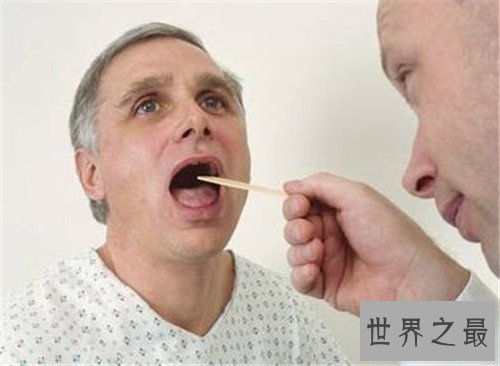 【图】咽炎的治疗方法有哪些 不迭时治疗很有能够危及