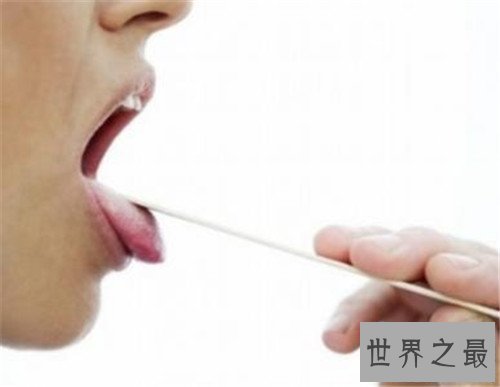 【图】咽炎的治疗方法有哪些 不迭时治疗很有能够危及