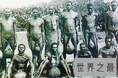 【图】象鼻族你知道长什么样子吗 他们真的有大鼻子吗